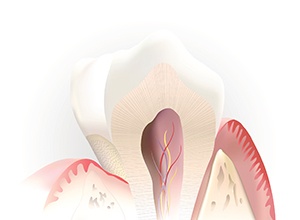 root canal diagram