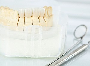 ceramic crowns