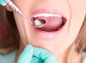 woman's teeth being checked with dental mirror