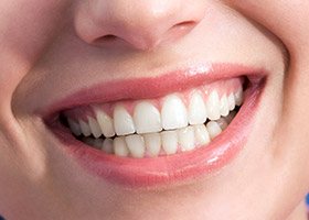 closeup of woman's smile