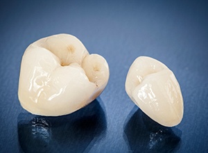 Fairfield same-day dental crowns on table