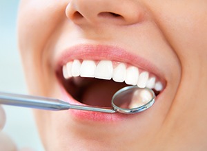 woman receiving dental checkup